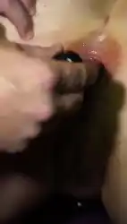 fisting