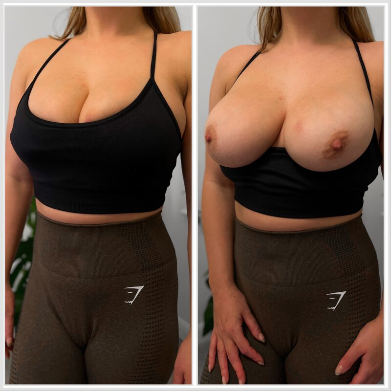 Huge collection of porn photos Big Tits Gym Huge Tits Leggings by Nick and Nicole’s (@nickandnicole)